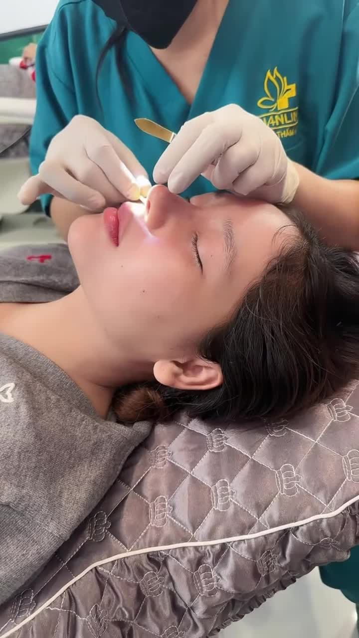 Mũi cấu trúc 10 ngày xinh dịu dàng nha