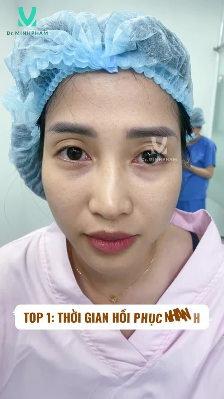 TOP 5 LÝ DO CHỊ EM NÊN CẮT MÍ ĐÓN TẾT XINH