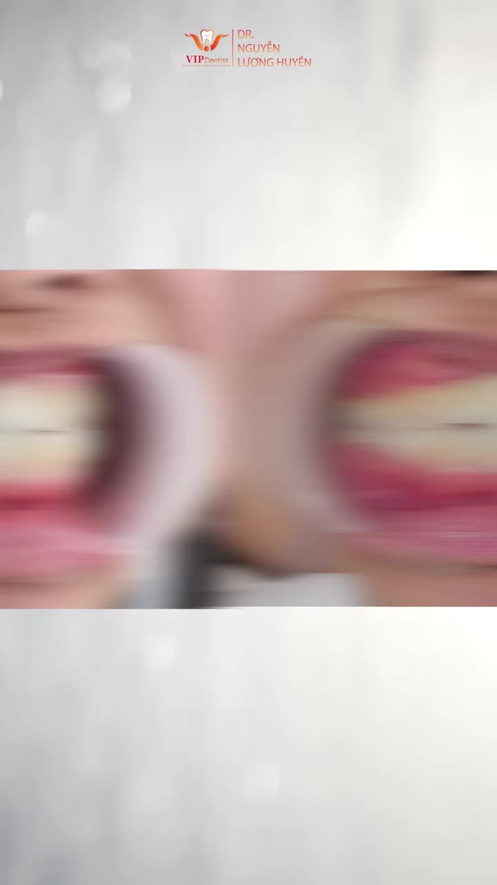 Sau quá trình điều trị, tình trạng răng khấp khểnh, khớp cắn ngược của bạn khách hàng đã thay đổi thế nào?