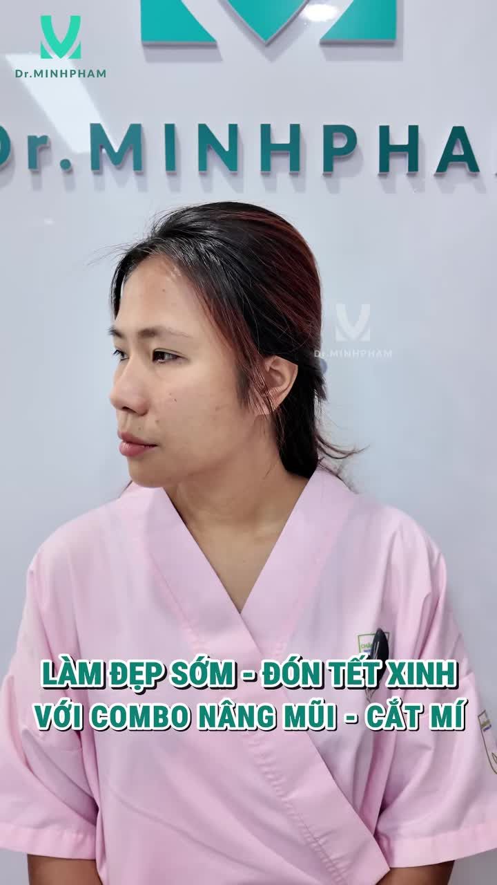 Combo Nâng Mũi – Cắt Mí