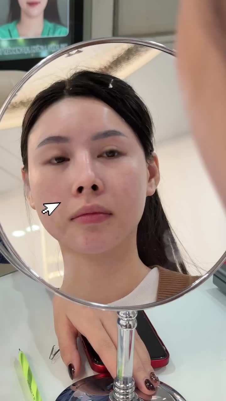 MŨI SỬA LẠI – KẾT QUẢ XỨNG ĐÁNG SAU BA LẦN THẤT VỌNG