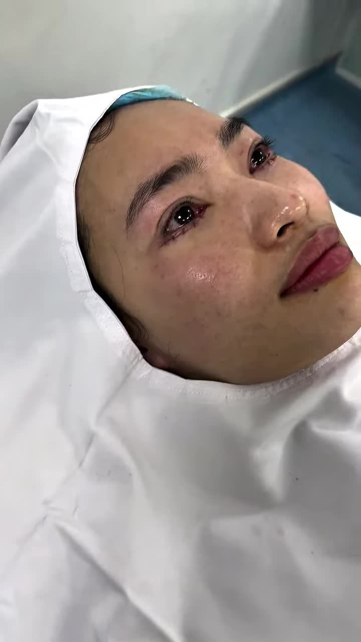 Phẫu thuật nhỏ – thay đổi to