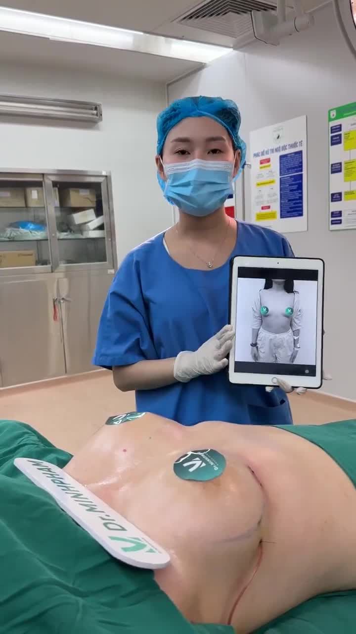 Siêu phẩm Mentor Xtra lên form ngay sau phẫu thuật