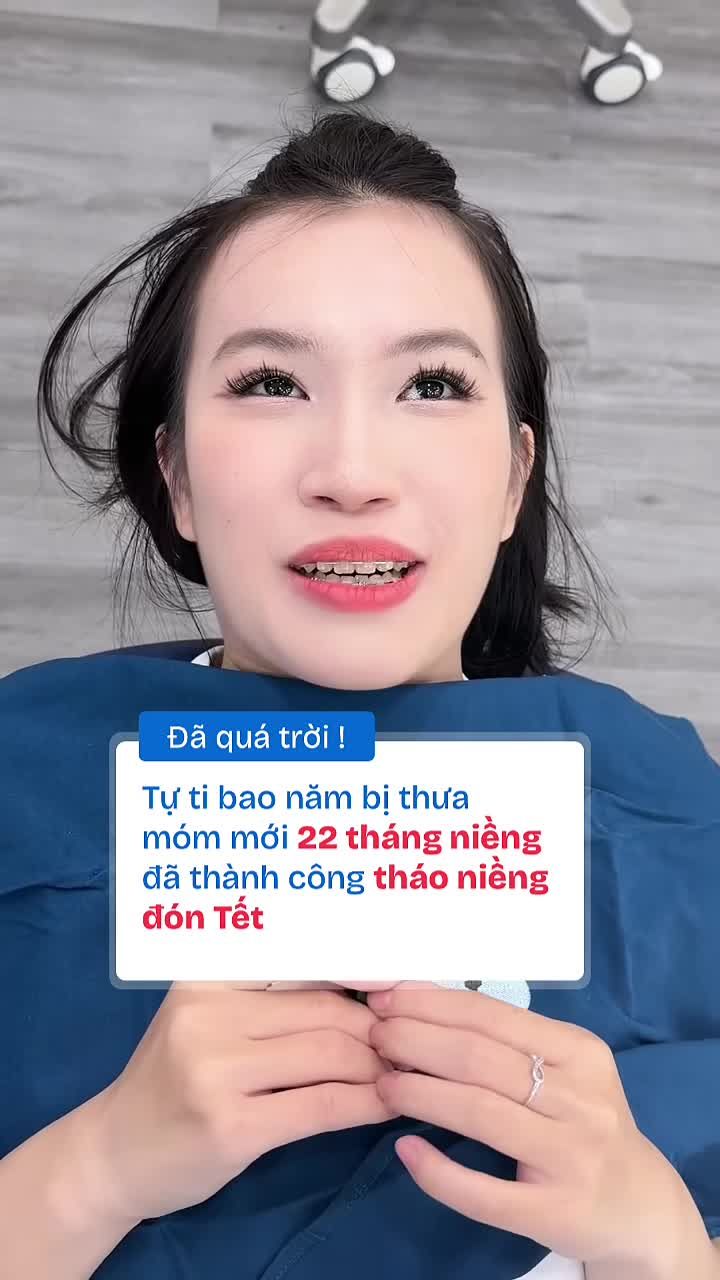 Đã quá trời! Niềng răng ở Nha khoa Paris chỉ 22 tháng đã tháo niềng thành công đón Tết!