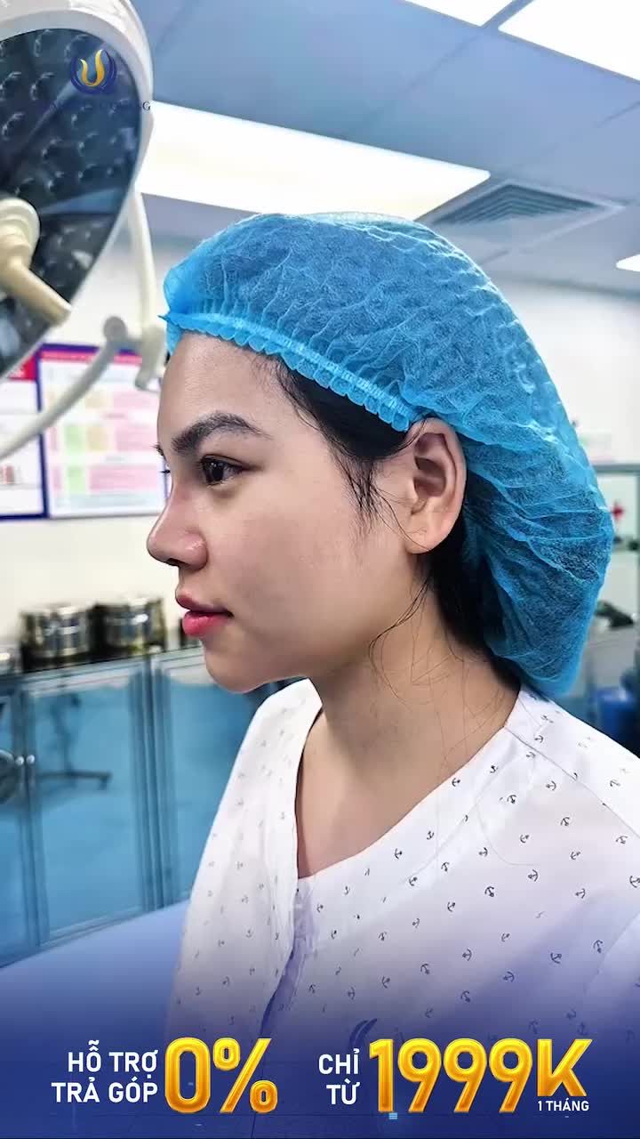 CẦN TÌM GÂP 19 KHÁCH HÀNG MŨI THẤP, TẸT, THIẾU SỨC SỐNG...
