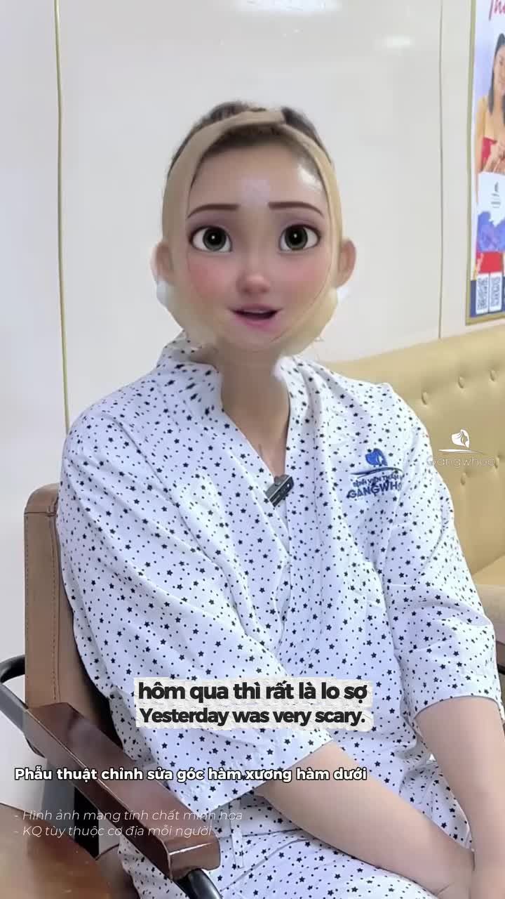 Tận hưởng trải nghiệm chăm sóc chu đáo 24/7, kết quả khiến cô ấy hài lòng tuyệt đối DMKT: Phẫu thuật chỉnh sửa thân xương hàm dưới