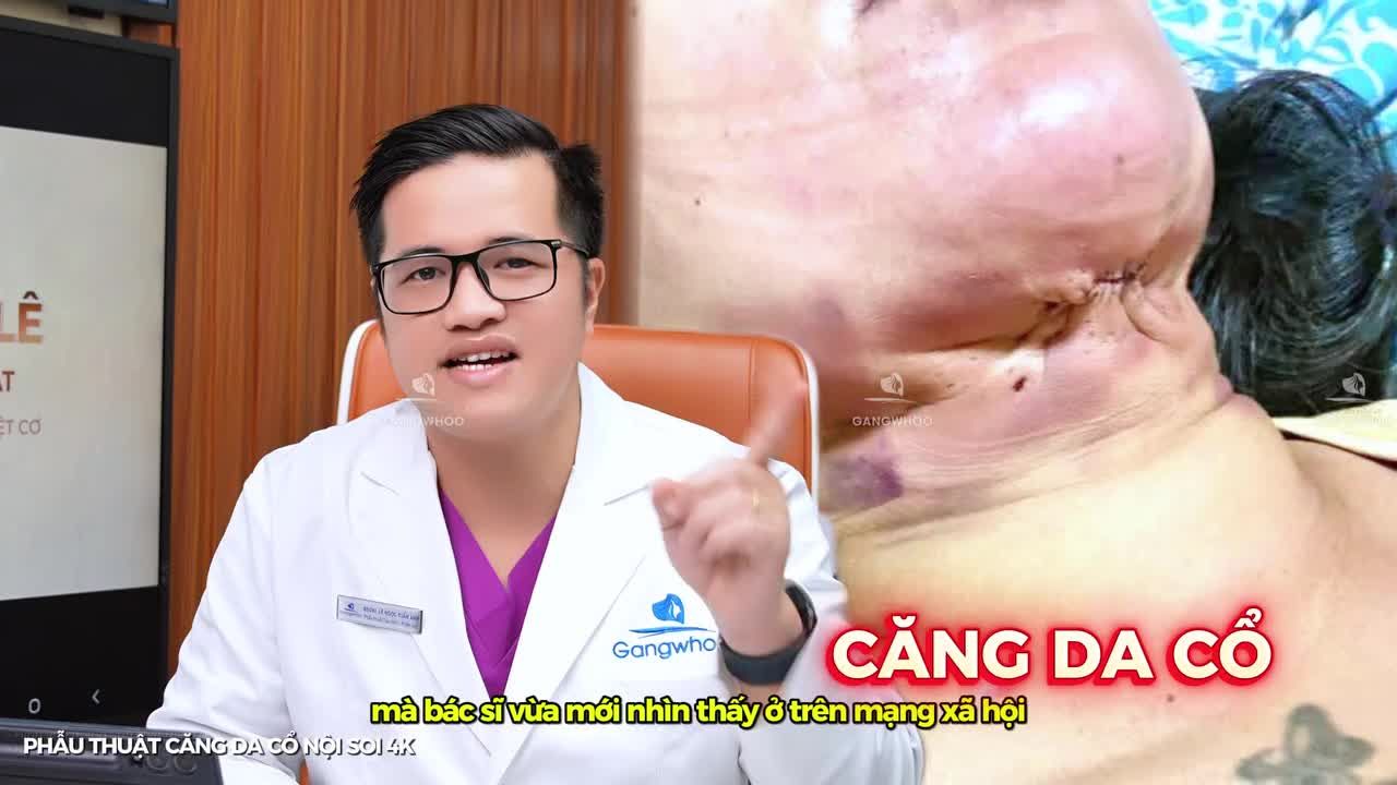 CẢNH BÁO NGUY HIỂM KHI PHẪU THUẬT CĂNG DA CỔ