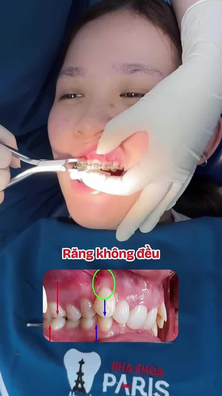 TẾT TRƯỚC CÒN NIỀNG - TẾT NÀY CƯỜI MÊ!