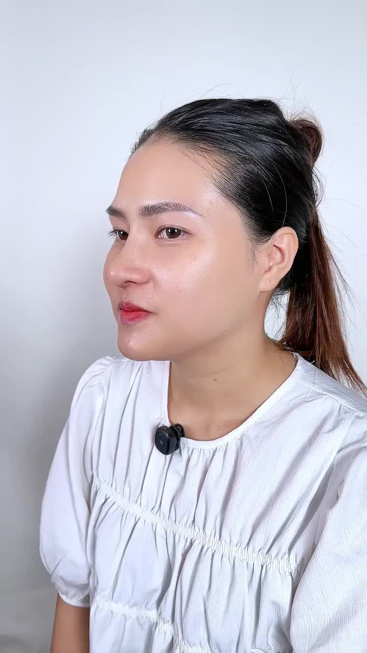 TÁI KHÁM 15 NGÀY SỬA MŨI HỎNG – HÀNH TRÌNH VƯỢT QUA RÀO CẢN TÂM LÝ