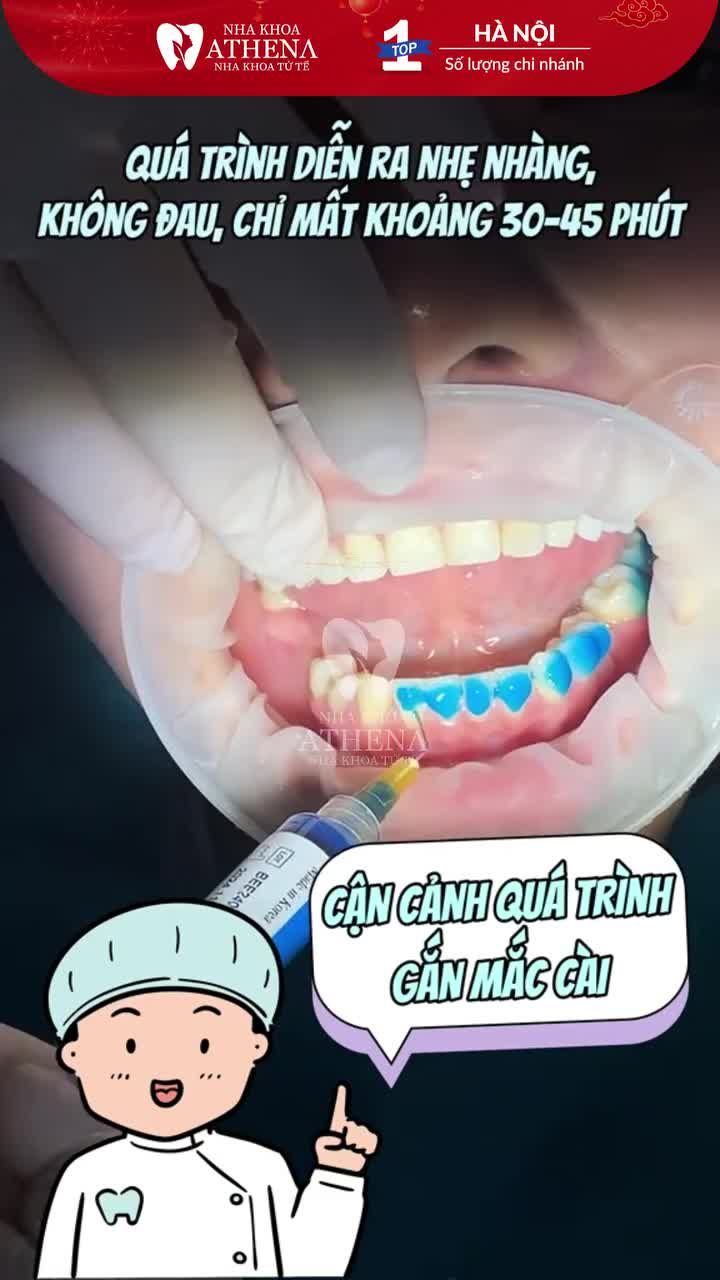 NGƯỜI ĐANG NIỀNG RĂNG CHƯA CHẮC ĐÃ THẤY CẢNH NÀY !!!