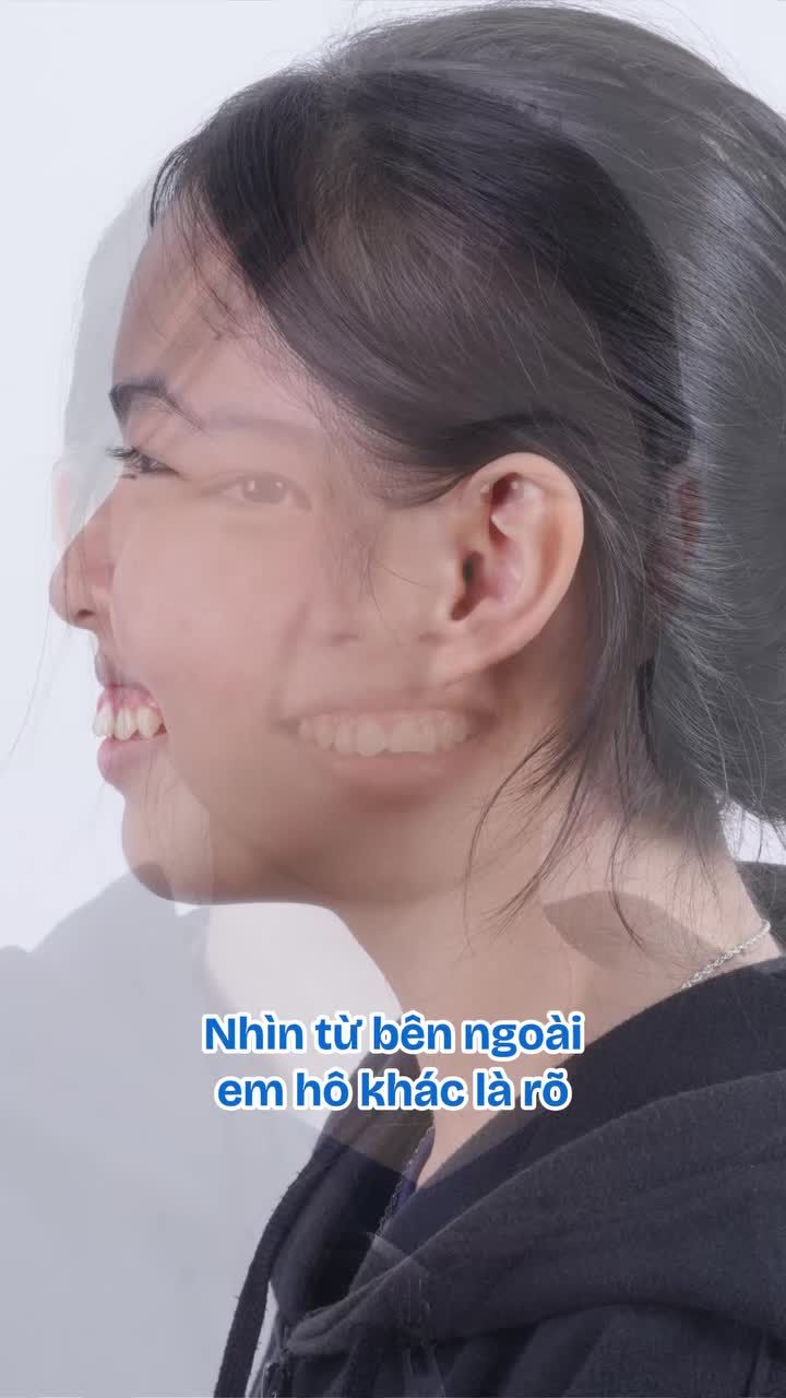 "Bác sĩ siêu mát tay, niềng hết hô mà không đau nhức gì!" KH. Phương Linh chia sẻ về hành trình niềng răng tại Nha khoa Paris