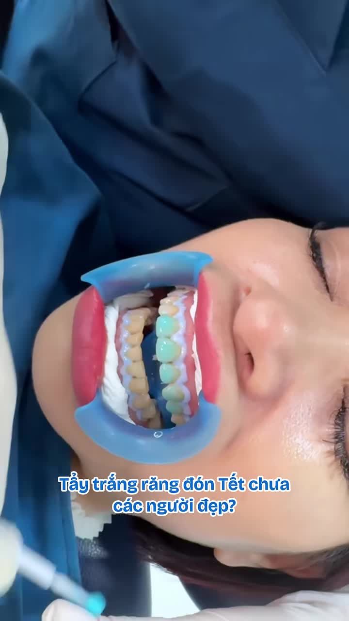 Tết sắp tới rồi… Đừng để răng ố vàng làm bạn ngại cười khi gặp người thân, bạn bè!