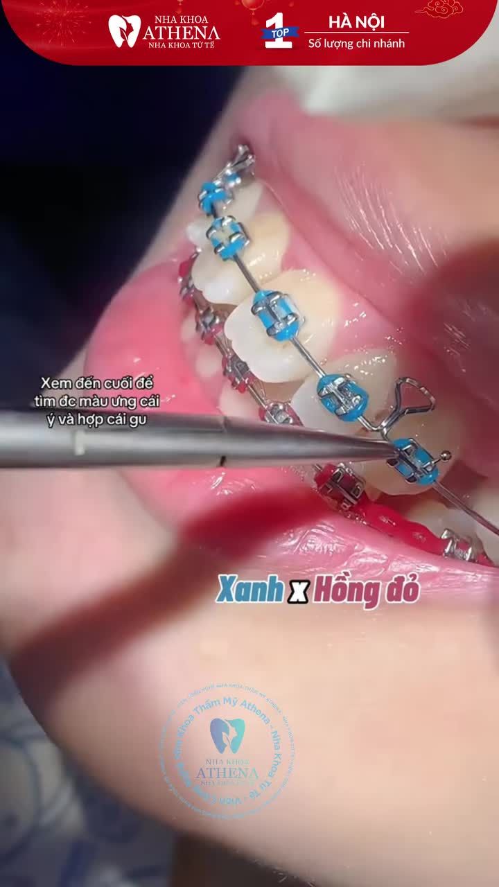 ĐỪNG THAY CHUN NIỀNG NẾU CHƯA XEM VIDEO NÀY!