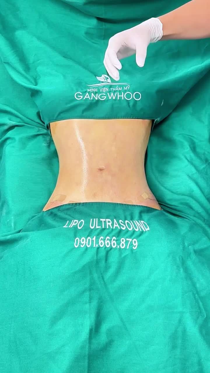 GIẢI CỨU VÒNG 2 – LẤY LẠI EO THON ĐÓN TẾT CÙNG KHÁCH HÀNG NGOẠI QUỐC
