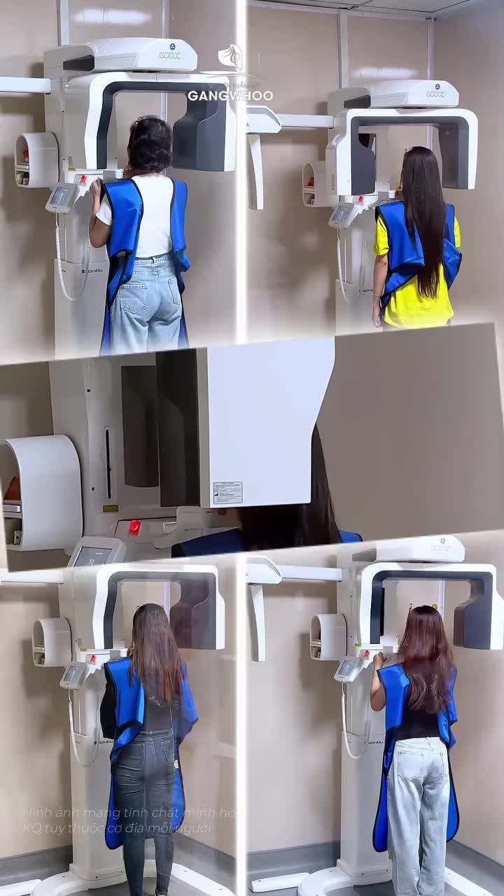 Vì sao phải chụp X-Quang AI điện toán trước khi nâng mũi tại BVTM Gangwhoo