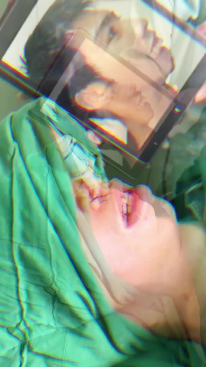 SUÝT KHÔΝG NHẬN RA 9X SAU CẮT XƯƠNG HÀM, XÓA HÔ VÌ ĐẸP HƠN CẢ SOÁI CA HÀN