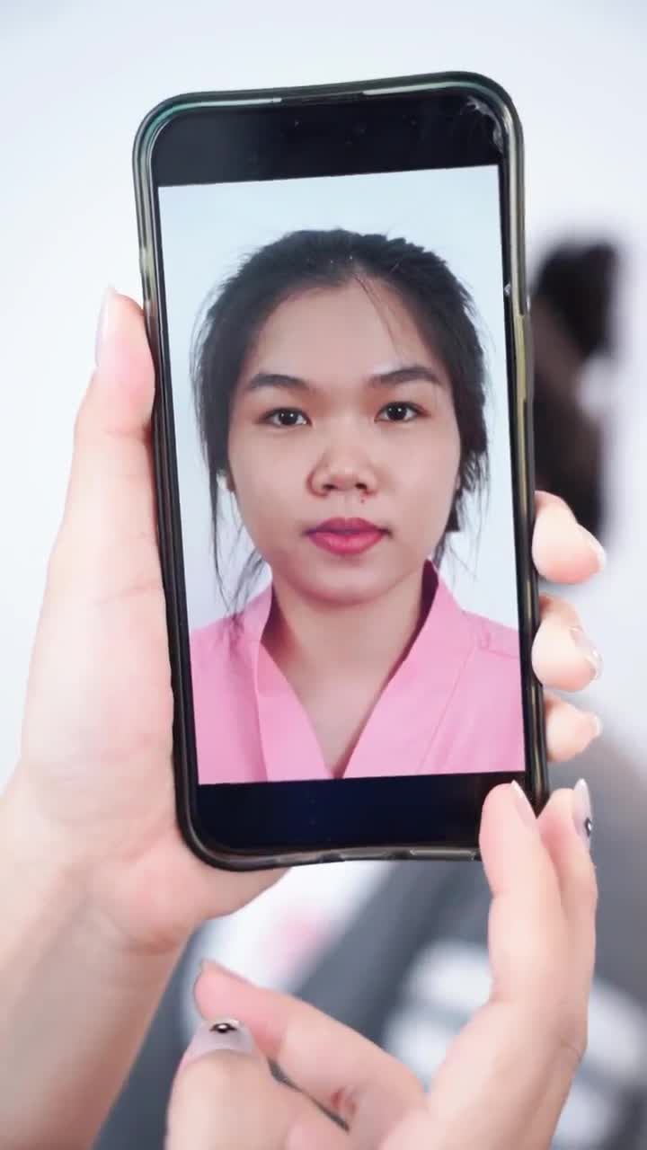 TÁI KHÁM MŨI ĐẸP CHUẨN FORM - SAU 3 THÁNG NÂNG MŨI CẤU TRÚC DR.HOẠT
