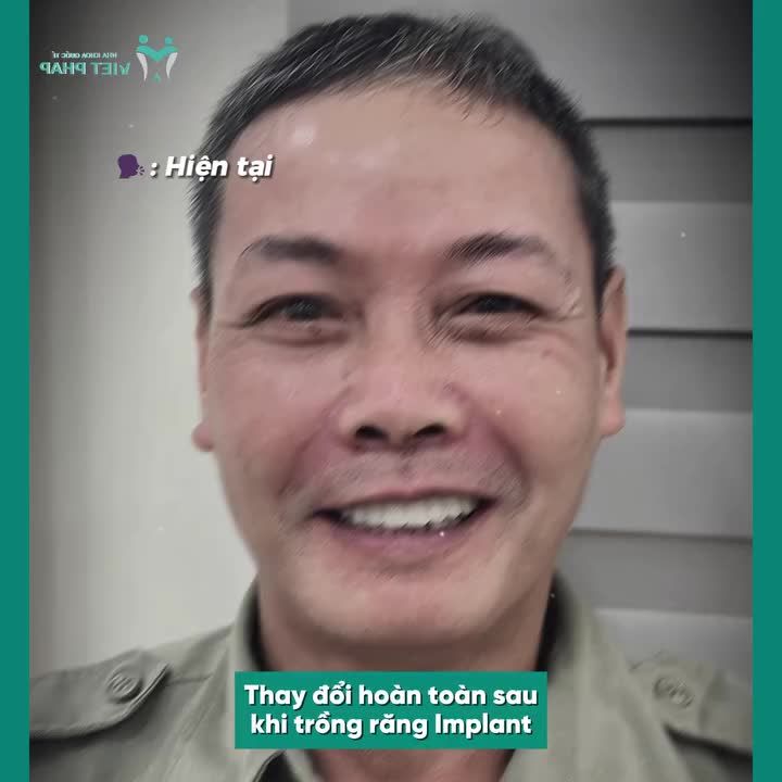 TUỔI 61 ĂN UỐNG NGON MIỆNG NHỜ TRỒNG RĂNG IMPLANT