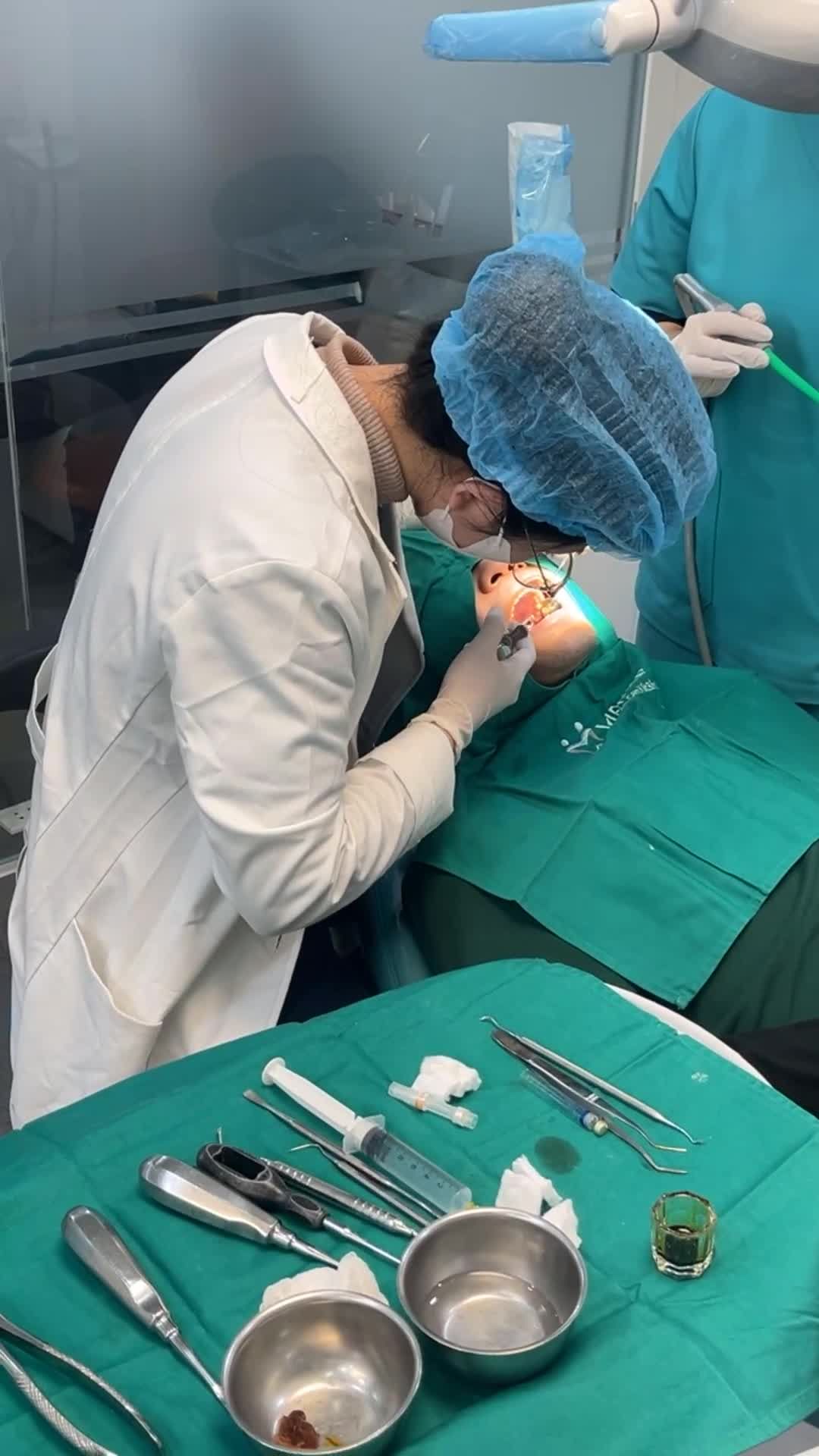 NHỔ RĂNG KHÔN ÊM ÁI CHỈ 10-15 PHÚT