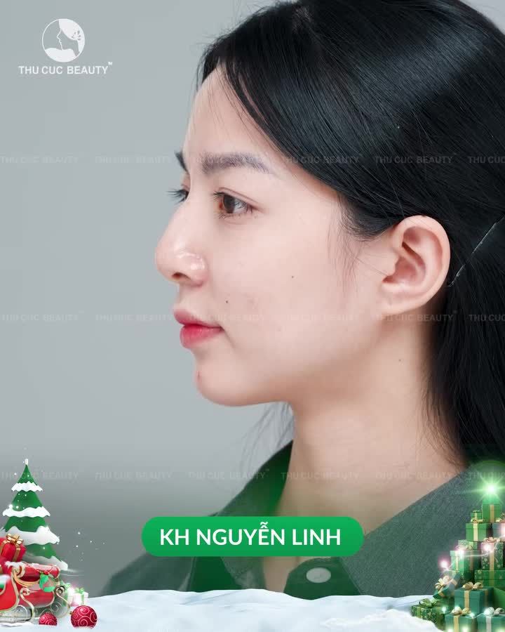 Điểm danh những màn lột xác chấn động hậu Nâng mũi tại Thu Cúc