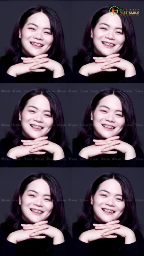 Răng xấu không đáng lo, không biết đến Viet Smile mới đáng lo.