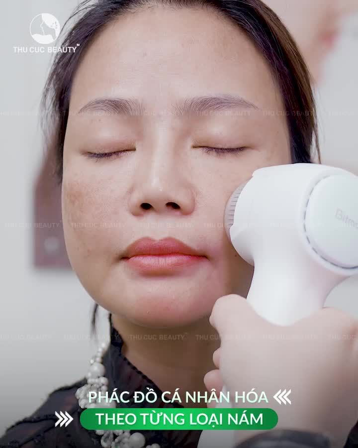 TỔNG HỢP CÁC CA TRỊ NÁM THỰC TẾ – NHÌN RÕ SỰ KHÁC BIỆT SAU ĐIỀU TRỊ