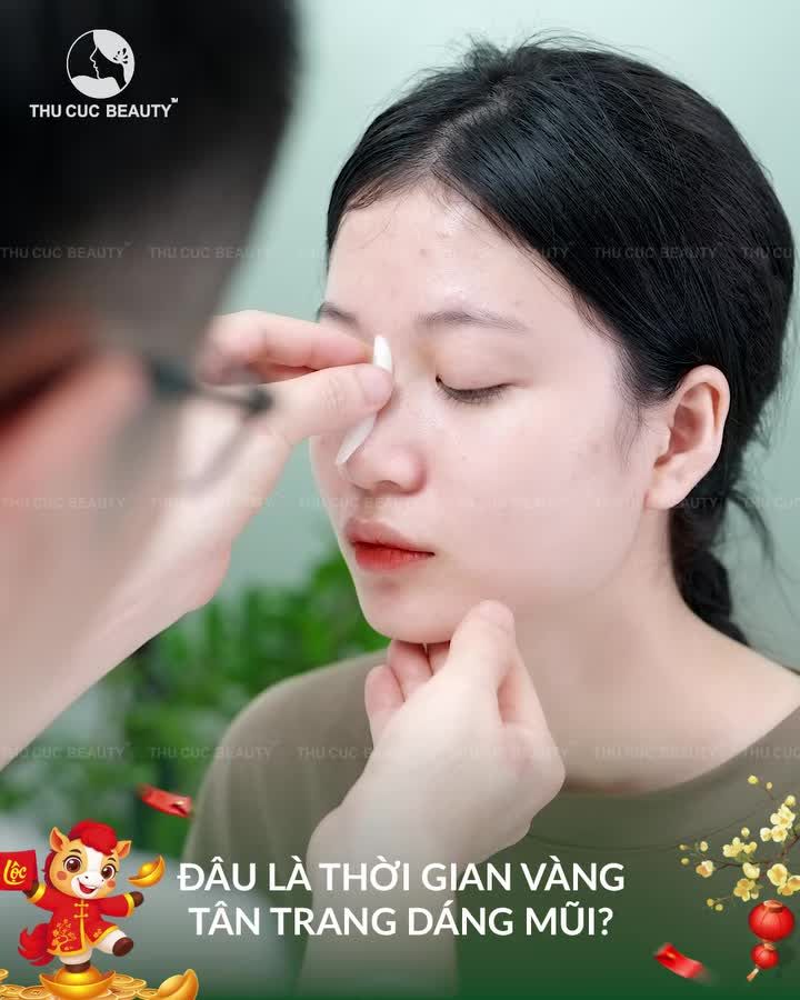 Nâng mũi đẹp sang - Đón Tết 2026 Thời điểm vàng F5 nhan sắc, tân trang giao diện