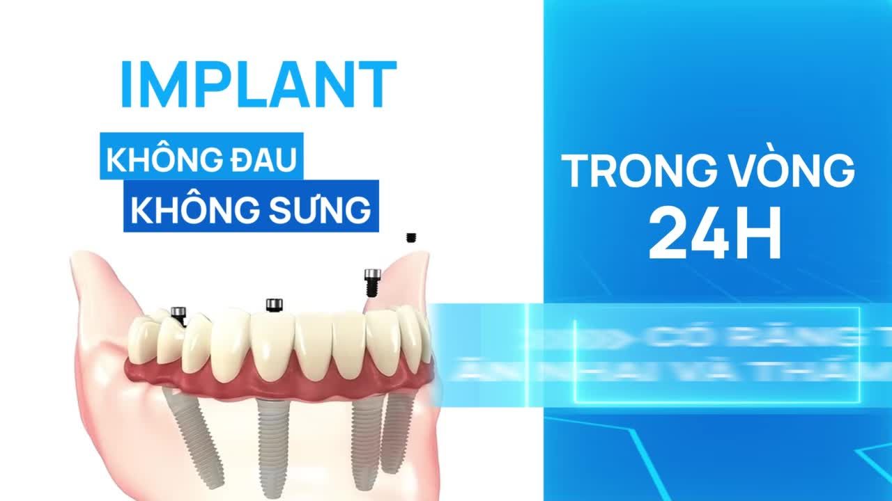 IMPLANT KHÔNG ĐAU? SỰ THẬT HAY CHỈ LÀ QUẢNG CÁO?