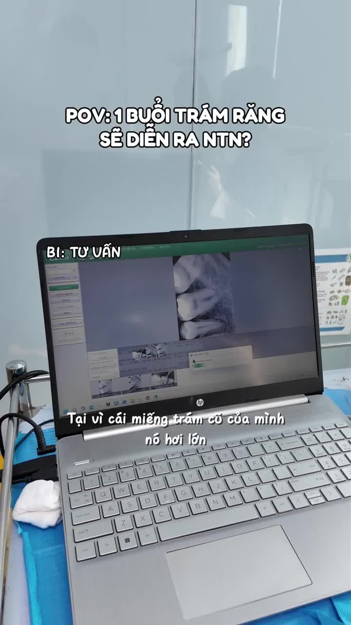 1 Buổi trám răng thực tế sẽ diễn ra ntn?