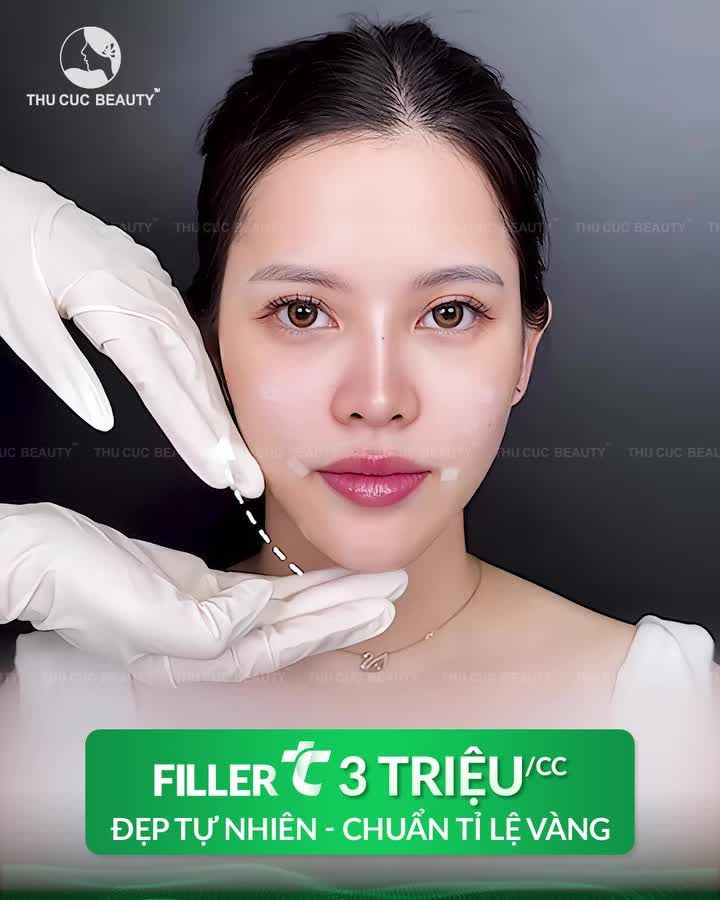 CHỈ CÒN 50 SUẤT FILLER TC – ĐẸP FULLFACE CHUẨN TỶ LỆ VÀNG CHỈ 3TR/CC!