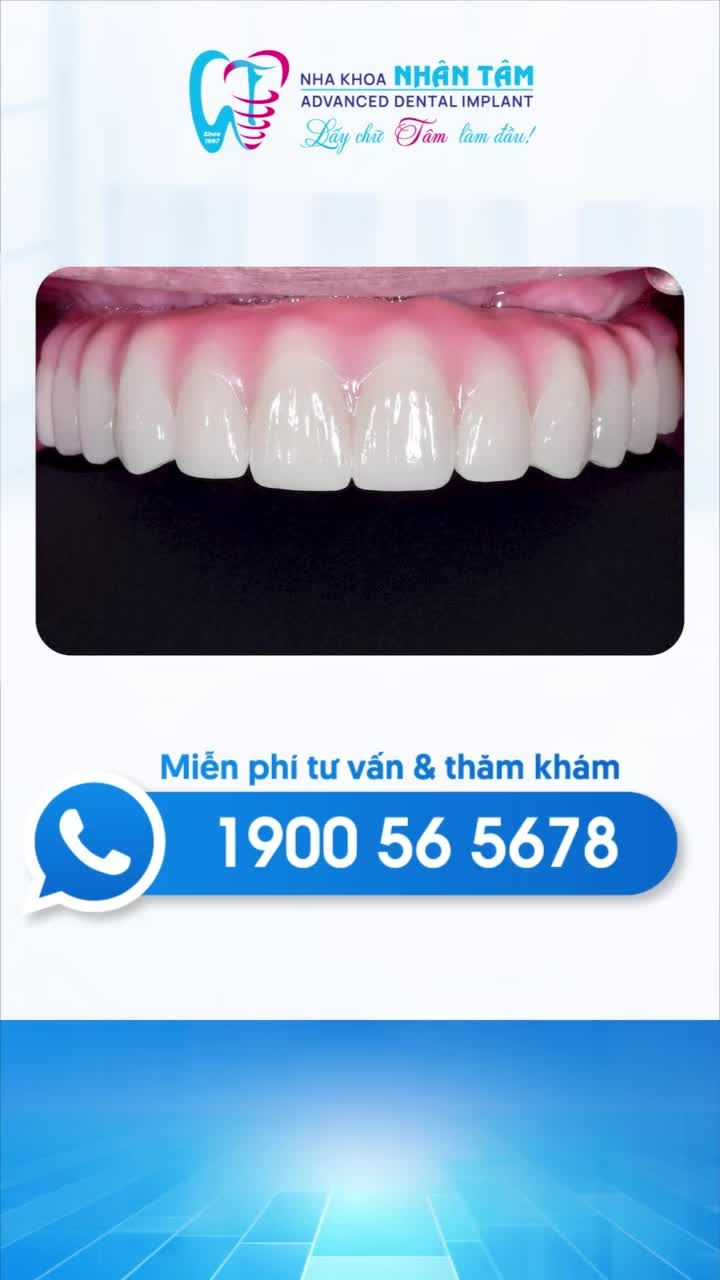 TRỒNG RĂNG IMPLANT THẾ HỆ MỚI: AN TOÀN - CHÍNH XÁC - ÍT ĐAU