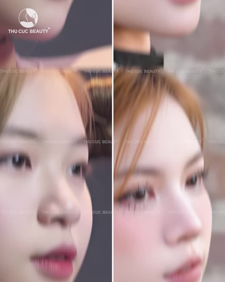 Tết này ai cũng trầm trồ vì…  Mũi + mí tự nhiên, không mất nét Vào form nhanh, lên dáng đẹp ngay  Chụp hình khỏi né góc vì góc nào cũng xinh