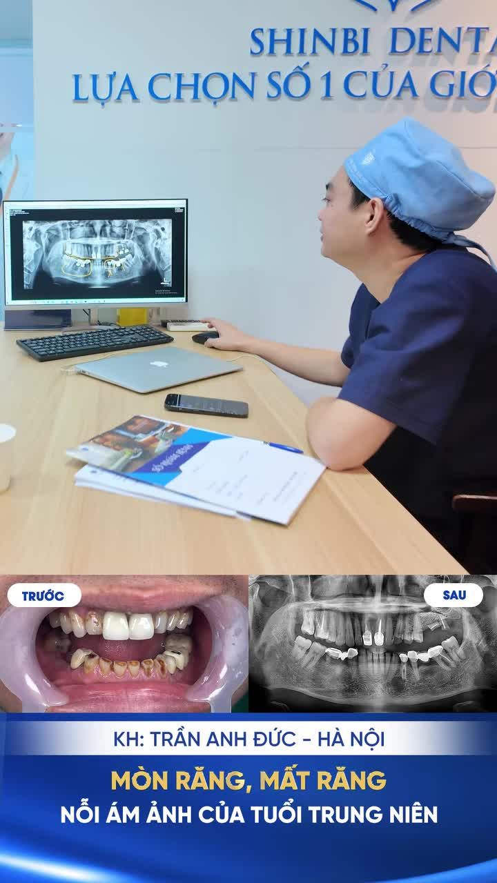 HÀNH TRÌNH TÁI TẠO NỤ CƯỜI MỚI CHO KHÁCH HÀNG TRẦN ANH ĐỨC (PHẦN 1)