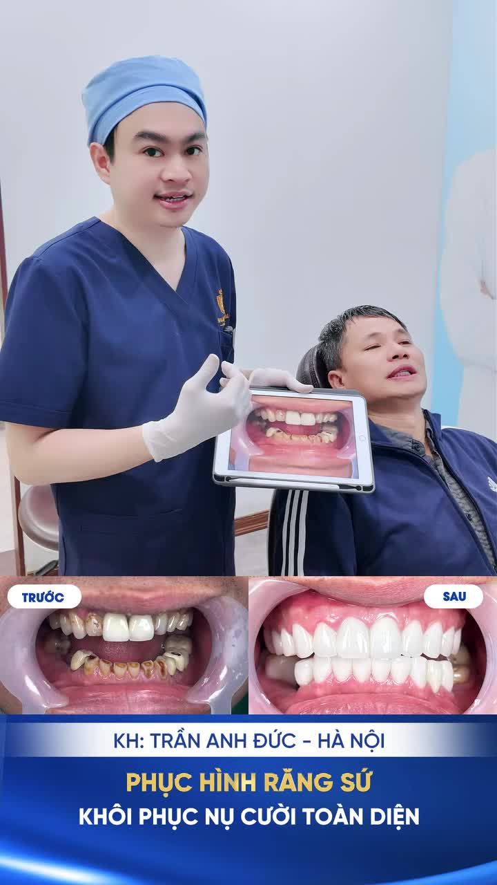 HÀNH TRÌNH TÁI SINH NỤ CƯỜI – GIAI ĐOẠN "VỀ ĐÍCH"