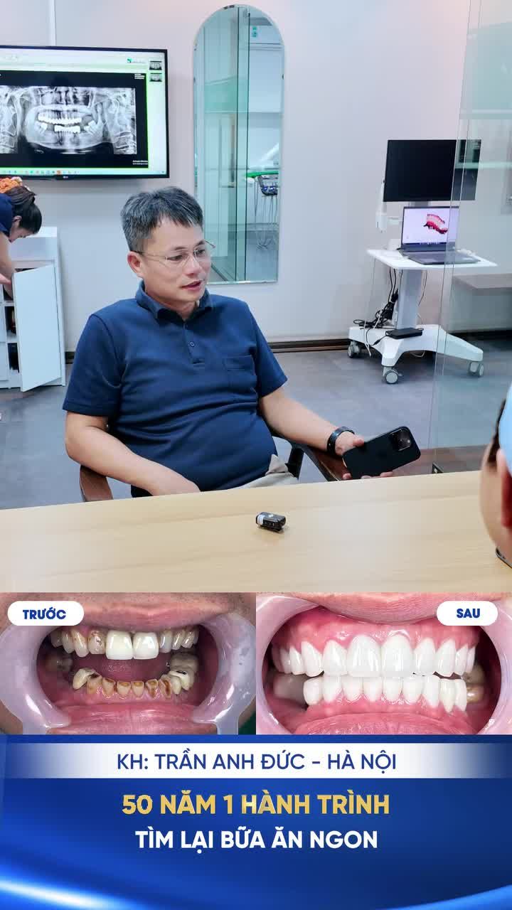 50 NĂM CHỊU ĐỰNG NỖI ĐAU VÌ HÀM RĂNG VÀ TRÁI NGỌT SAU 2 TUẦN TẠI NHA KHOA SHINBI