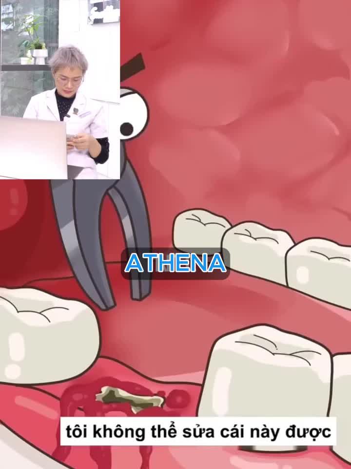 NHỔ RĂNG SÂU NHƯNG VẪN... CÒN CHÂN RĂNG?