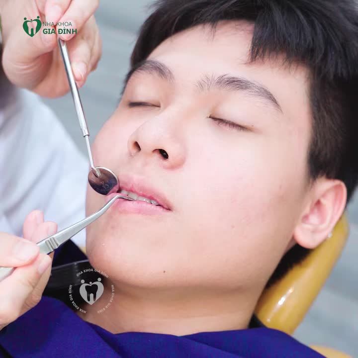 Trước khi tiến hành gắn mắc cài, Bác sĩ Trang luôn dành thời gian thăm khám và phân tích kỹ lưỡng tình trạng răng của từng khách hàng.