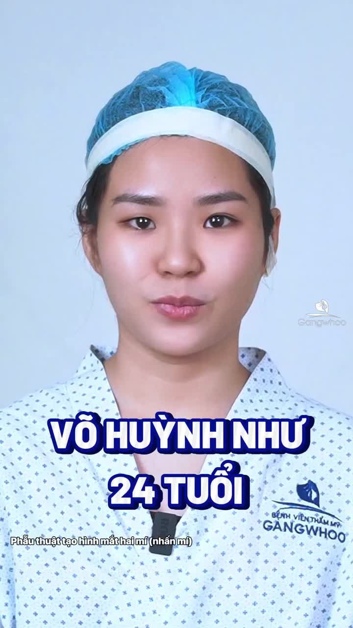 Giải pháp tạo hình mắt hai mí hài hòa cho khách hàng trẻ tuổi, ưu tiên vẻ đẹp tự nhiên.  DMKT: Phẫu thuật tạo hình mắt hai mí (nhấn mí)