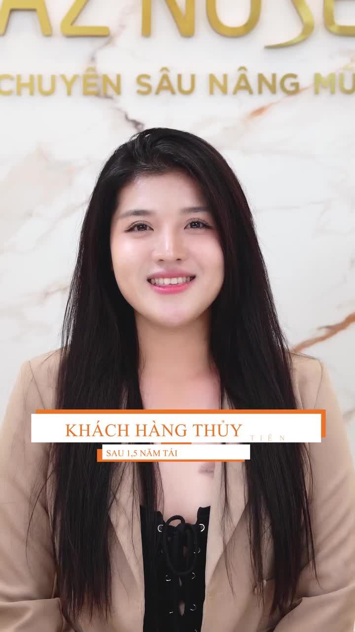 Từ mũi lộ sóng đến dáng mũi ổn định sau 1.5 năm...