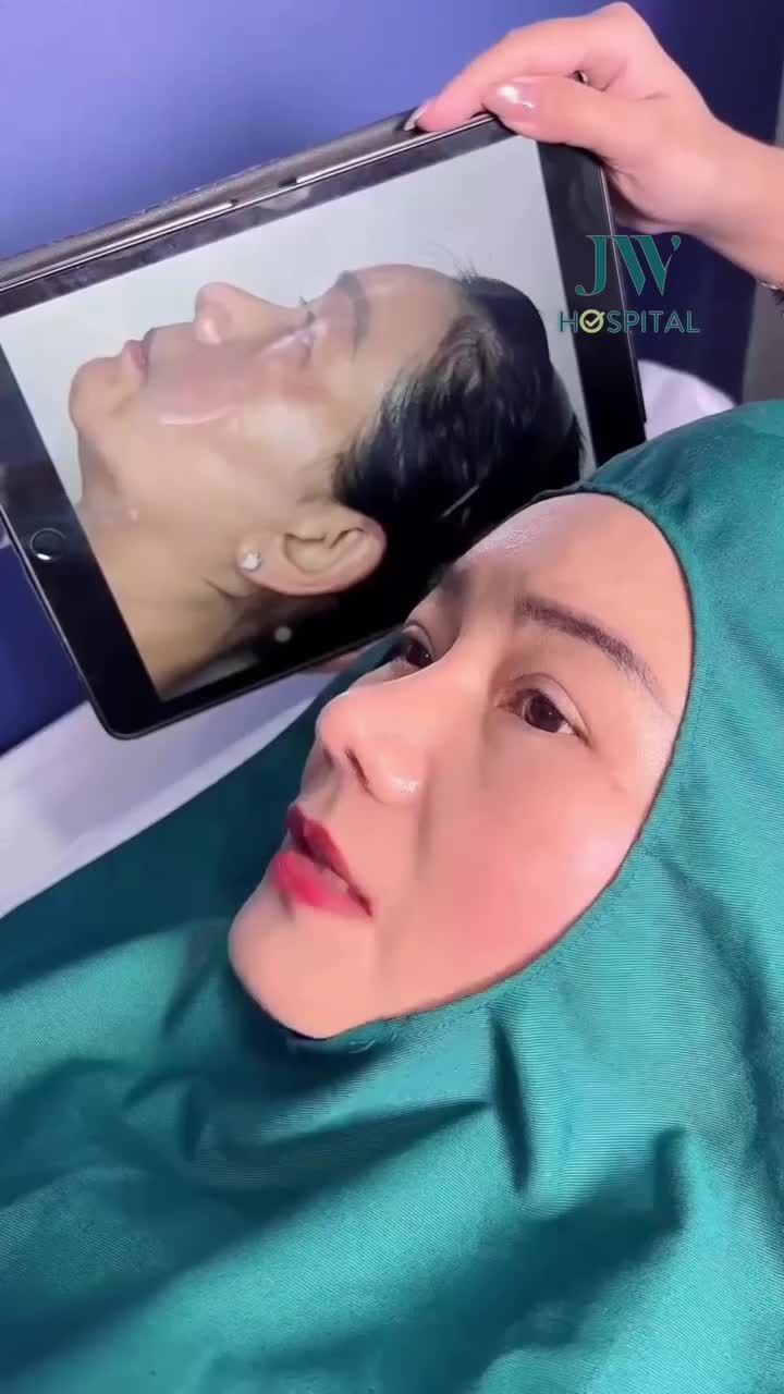 U50 VIỆT KIỀU ÚC CHI TRĂM TRIỆU HỒI XUÂN 20 TUỔI ĂN TẾT SAU COMBO TRẺ HOÁ MẮT, NÂNG MŨI S LINE 3D TẠI JW