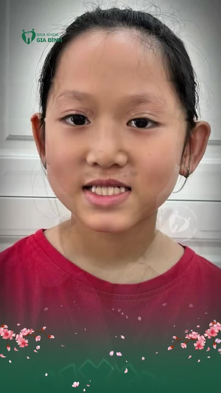 NIỀNG RĂNG NGAY TỪ NHỎ - CON TỰ TIN MỖI NGÀY