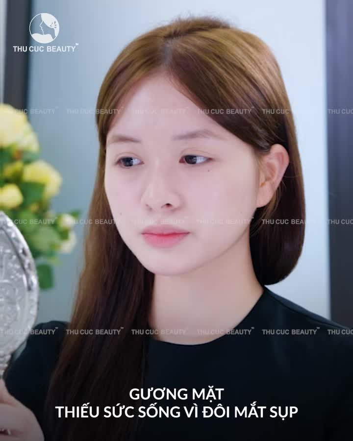 Tạm biệt mí sụp – Chào đôi mắt cuốn hút