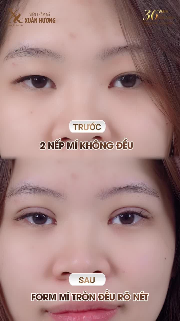 TẠM BIỆT MÍ SỤP - NẾP MÍ LÓT - ĐA NẾP MÍ - 2 MÍ KHÔNG ĐỀU