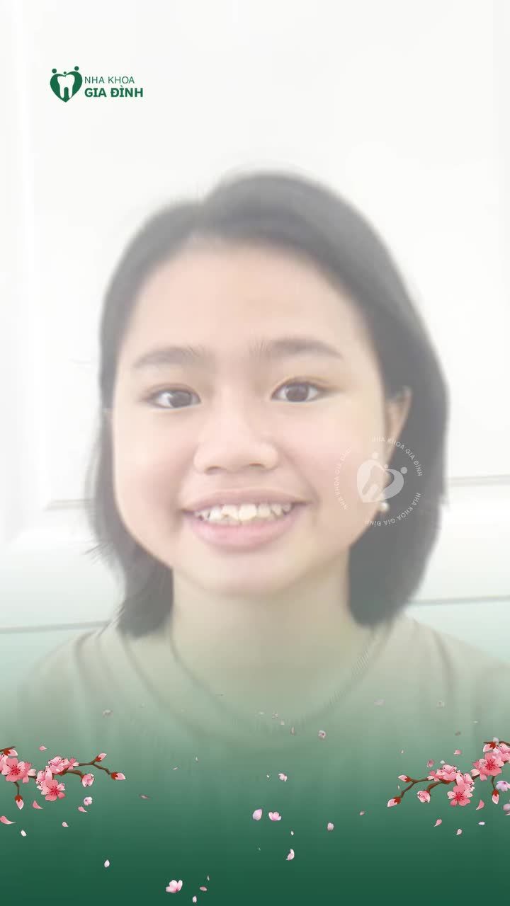 CON RỤT RÈ VÌ RĂNG CHƯA ĐẸP. NIỀNG HÔM NAY, CON TỰ TIN MAI SAU