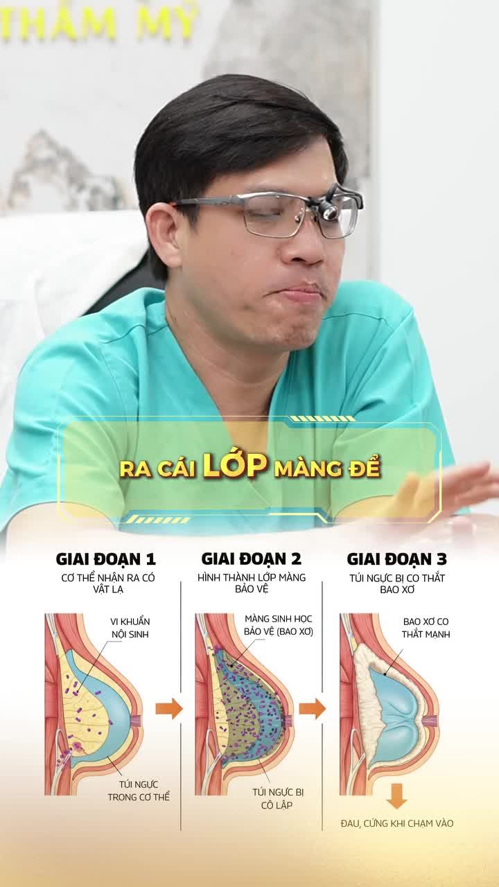 Nên chọn dòng túi Mentor hay Motiva?