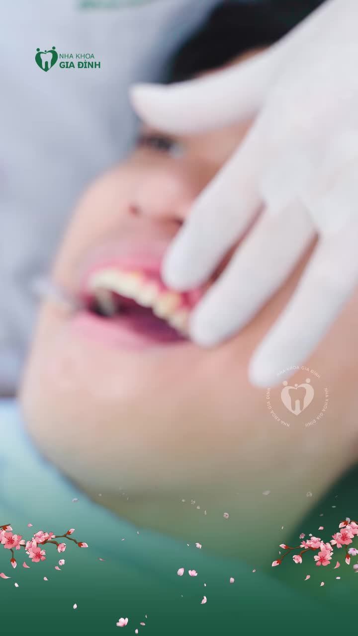 DẬY THÌ THÀNH CÔNG NHỜ NIỀNG RĂNG LÀ CÓ THẬT NHA