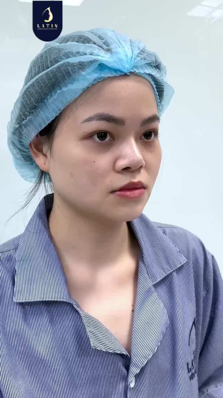 SỰ THAY ĐỔI BẮT ĐẦU TỪ CHÂN CÁNH MŨI