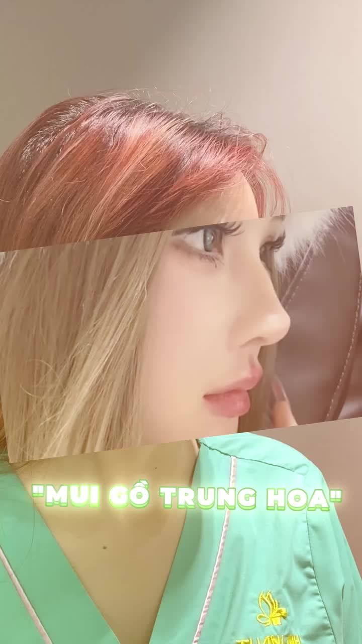 NÂNG MŨI THIẾT KẾ DÁNG PHONG THỦY – ĐẸP TỪNG ĐƯỜNG NÉT, VƯỢNG TÀI VƯỢNG LỘC