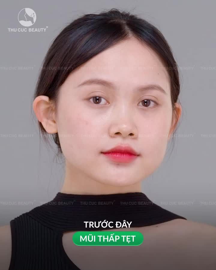 Biến hình ngoạn mục với dáng mũi mới