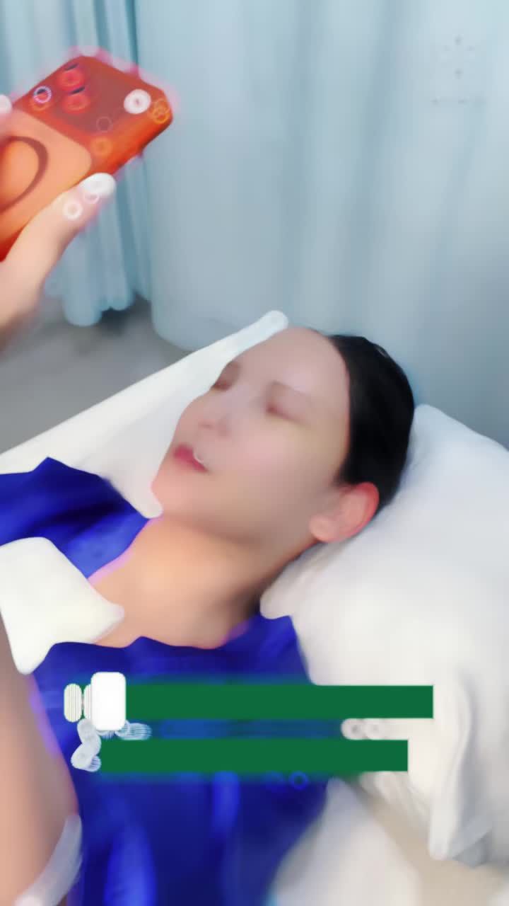 Khách hàng cắt chỉ sau 7 ngày Treo cung mày - Hút mỡ cạnh cằm và làm phẳng da bằng công nghệ IGNITE RF